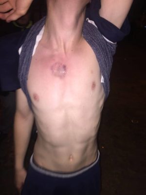 Derry: proiettile di gomma contro un giovane | © Foto Saoradh